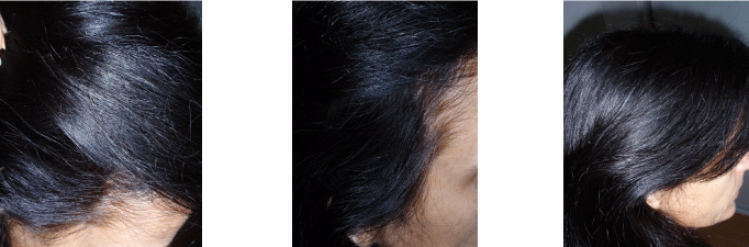 Vlasy po použití dvoufázového barvení